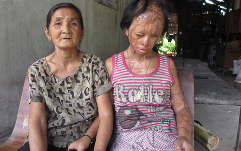 Bà nội bé gái bị tạt axit năm 7 tuổi vì mẹ "giật chồng" người khác rồi bỏ rơi đã đến TP.HCM để xin đôi mắt tử tù cứu cháu