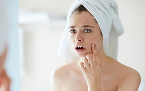 Nhiều người bị hoại tử mặt do dị ứng mỹ phẩm, cần làm ngay những điều này để sơ cứu khi bị dị ứng mỹ phẩm kịp thời!
