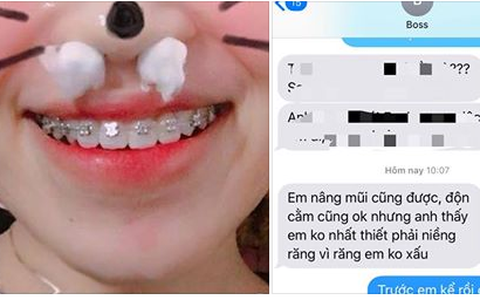 Cô gái tội nghiệp đăng đàn thở than về tình huống éo le: Sau khi làm đẹp cười với người yêu một cái thế là... mất luôn bạn trai