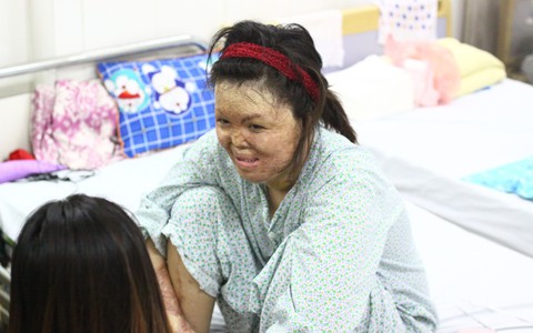 Sau 2 năm và hàng chục cuộc phẫu thuật, người vợ Hà Nội bị chồng thiêu hôm mùng 2 Tết, chỉ có 1% cơ hội sống sót đã "hồi sinh"