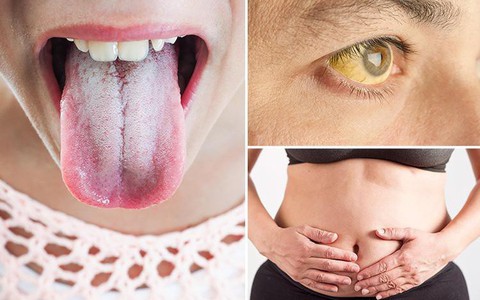 Đây là 5 tín hiệu chứng tỏ cơ thể đang cố gắng muốn nói rằng bạn đang bị bệnh, đừng lơ là bỏ qua 
