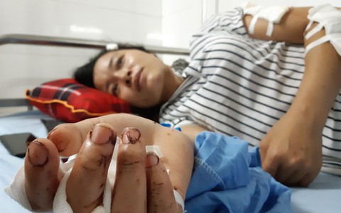Lời kể của nạn nhân sống sót trong vụ thảm sát 3 người ở Thái Nguyên: "Suýt chút nữa là gia đình tôi chết cả rồi"