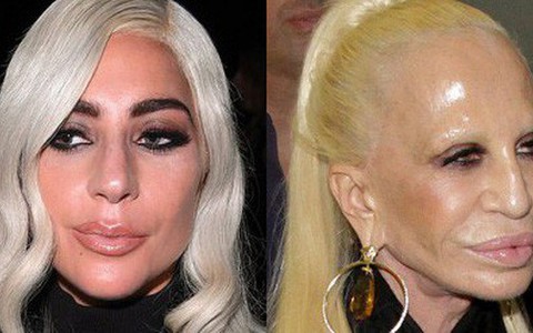 Mặt cứng đơ kém sắc, Lady Gaga bị nghi lạm dụng thẩm mỹ giống "thảm họa dao kéo" Donatella Versace
