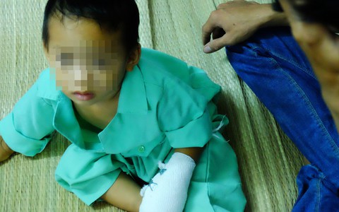 Tai nạn đau lòng: Bé trai 3 tuổi đứt lìa ba ngón tay vì nghịch máy xay bột làm nhang