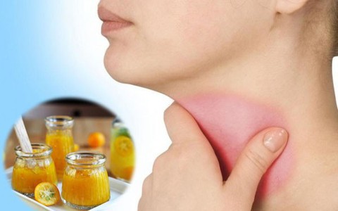 Khàn giọng, mất tiếng sau đêm cổ vũ bóng đá: Hãy tìm ngay những bài thuốc chữa bệnh tại nhà cực hiệu quả này