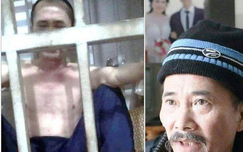 Trưởng công an huyện thông tin vụ người chồng ở Thanh Hóa tố bị vợ nhốt trong cũi sắt