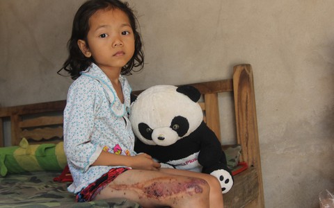 "Em quỳ gối xin mọi người cứu lấy con em, không có tiền phẫu thuật bướu máu con bé sẽ chết"