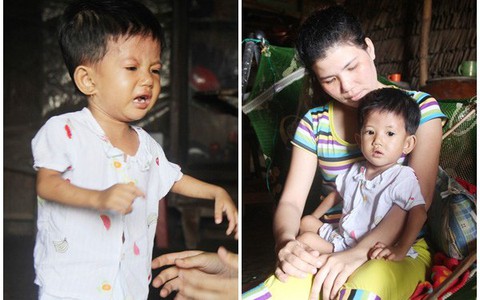 Lời khẩn cầu của người mẹ ôm con gái 2 tuổi bị hở van tim, chỉ nặng 6 ký mà không có tiền chạy chữa