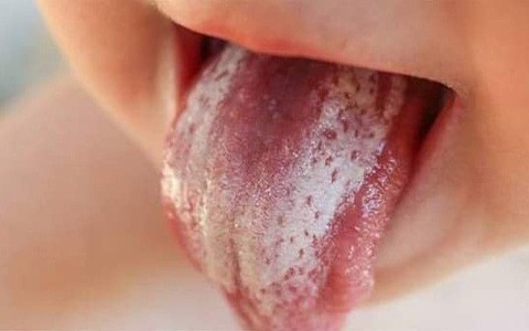 Bà mẹ gây sốc khi hướng dẫn tỉ mỉ cách rơ lưỡi cho con bằng... nước tiểu