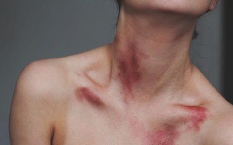 Ngoài cổ, phụ nữ đừng để chồng hôn quá mạnh vào vùng nhạy cảm này mỗi khi "quan hệ" bởi đã có người thiệt mạng vì làm vậy