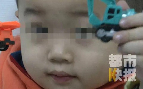 Bé trai 3 tuổi bị mù suốt 10 ngày chỉ vì bị cảm lạnh nhưng không điều trị dứt điểm