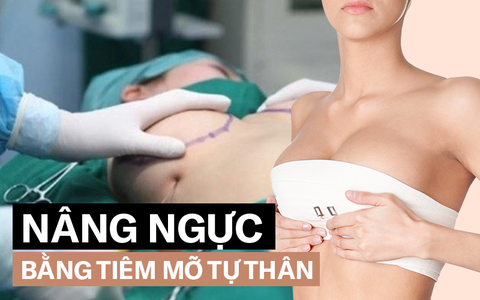 Hút mỡ tự thân để nâng ngực: Chuyên gia khẳng định dễ gặp biến chứng, nguy hiểm tính mạng