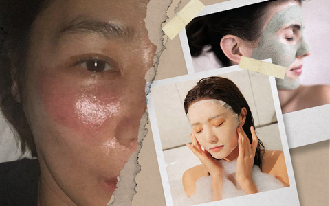 Mỹ nữ xứ Hàn bị bỏng rát mặt chỉ vì một lần đắp mặt nạ qua đêm: Lời cảnh báo thói quen làm đẹp chị em cần chấn chỉnh!