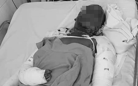 Nhà bốc cháy lúc đang ngủ, hai vợ chồng ở Lâm Đồng chỉ kịp cứu 3 con rồi hóa thành 'ngọn đuốc sống'