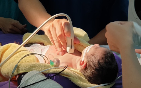 Bé sơ sinh 1 ngày tuổi bị bệnh tim bẩm sinh phức tạp, bác sĩ phải phá vách liên nhĩ để cứu sống bé