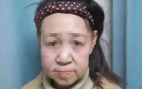 Cô gái 15 tuổi trông như bà cụ hơn 60 tuổi, càng sốc hơn khi nhìn thấy hình ảnh người mẹ