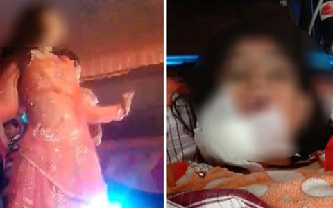 Vừa mới ngừng múa hát trong đám cưới, vũ công nữ bất ngờ ôm lấy khuôn mặt đầy máu và lảo đảo ngã xuống sàn