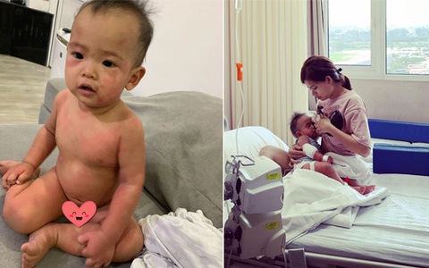 Con 11 tháng tuổi “dính” combo sốt siêu vi 4 ngày - dị ứng 3 ngày, lời khuyên của mẹ trẻ cho các phụ huynh lúc giao mùa 