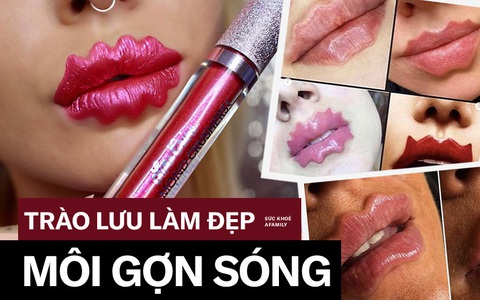 "Môi gợn sóng": Trào lưu làm đẹp kỳ quái và nguy cơ kinh hoàng nếu chị em bất chấp bơm chất làm đầy để chạy theo xu hướng