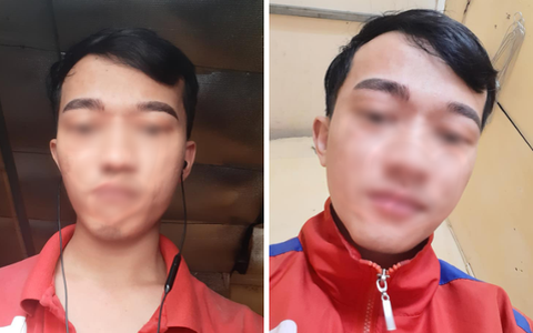 Nam thanh niên cầu cứu dân mạng sau khi nghe lời bạn đi điêu khắc lông mày, nhìn hình ảnh chẳng biết nên cười hay nên khóc