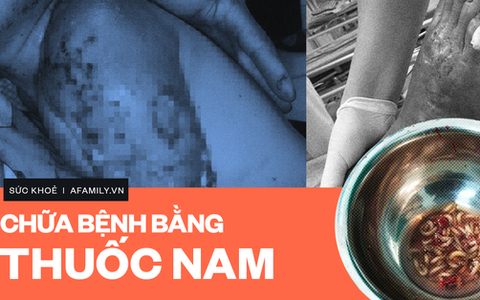 Năm 2019: Nhiều ca bệnh biến chứng nặng nề vì chữa bệnh theo tin đồn bằng thuốc nam và lời cảnh báo của chuyên gia!