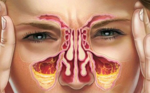 Người đàn ông bị nghẹt mũi, đêm ngủ ngáy, đi khám xong thì sốc bởi phát hiện bệnh nguy hiểm