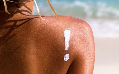 Ngộ độc nắng và cách giảm thiểu những cơn đau do tình trạng này gây nên