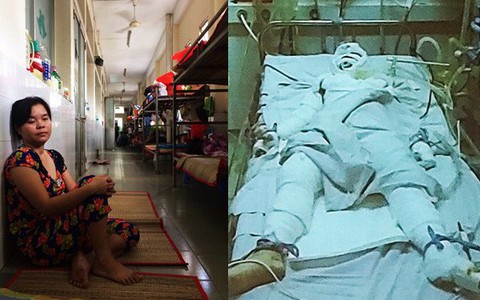 Chồng và con gái bỏng rất nặng, người phụ nữ nuôi bệnh xuyên suốt Tết Nguyên Đán, đã mắc nợ gần 200 triệu đồng 