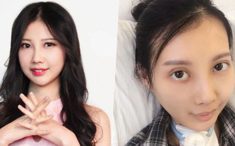 7 năm chống chọi với ung thư, nữ ca sĩ Hong Kong thoi thóp, không thể tự chủ trong năm tháng cuối đời