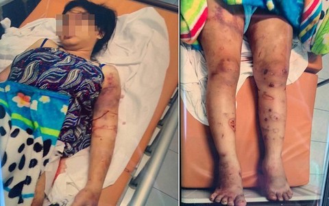 Lời khai rùng rợn của nhóm đòi nợ, tra tấn khiến cô gái 18 tuổi mang bầu 6 tháng sảy thai