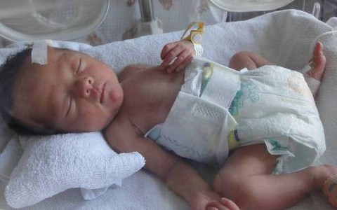 Bé sinh non 28 tuần tuổi nhập viện trong tình trạng viêm ruột hoại tử, cha mẹ vỡ lẽ nguyên nhân là do yêu thương con quá mức