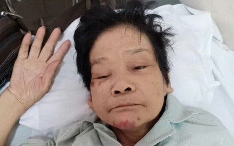 Hà Nội: Tìm người thân cho một phụ nữ lớn tuổi, mất trí nhớ tại bệnh viện E
