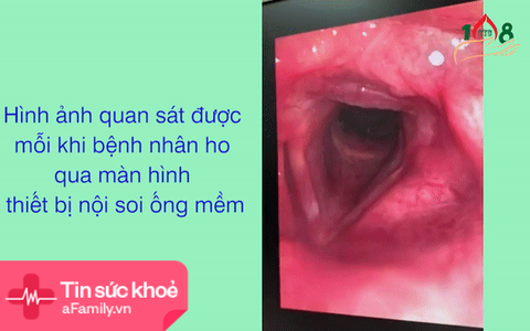 Bác sĩ bắt con đỉa ngoe nguẩy trong khí quản người đàn ông