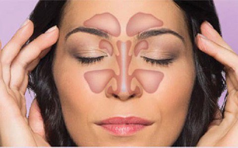 Đau đầu do dị ứng: Những điều chuyên gia muốn ai cũng biết để loại bỏ bệnh càng sớm càng tốt