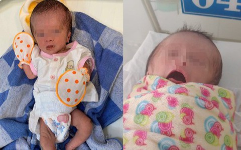 Bé gái sơ sinh ở Lâm Đồng bị mẹ bỏ trong bọc xốp treo trên cây 3 ngày sẽ không thể phát triển bình thường