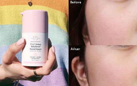 Làn da từ đầy tỳ vết thành mịn đẹp xuất sắc nhờ phương pháp peel da, nhưng không chú ý những điều sau thì "hỏng bét" 