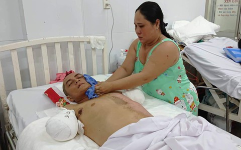 Đi làm nuôi mẹ già bị tai biến, chồng bị điện giật phải cắt 2 tay, vợ và 4 con đau đớn gom góp tiền cứu bố