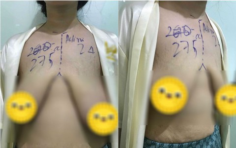 Bức ảnh bộ ngực chảy xệ vì sinh con xuất hiện đúng Ngày của mẹ khiến hội chị em xót xa, vài giờ sau đó có điều gây bất ngờ