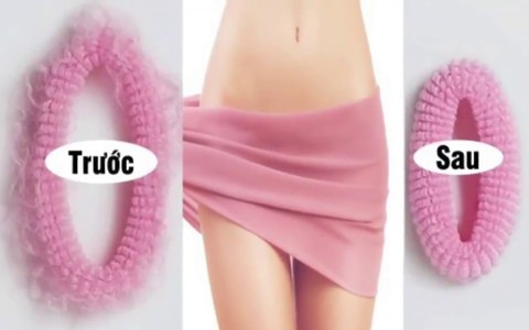 Thu hẹp vùng kín là ước mơ của nhiều chị em sau sinh nhưng chuyên gia muốn bạn biết điều này