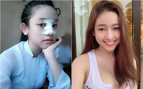 Thúy Vi không tiếc tay chi tiền tỷ phẫu thuật thẩm mỹ, nhưng lại nhận mình là "hot girl sống khổ nhất Việt Nam"