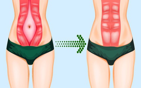 6 bài tập sau khi sinh con các mẹ sẽ cần để nhanh chóng lấy lại vóc dáng thon gọn