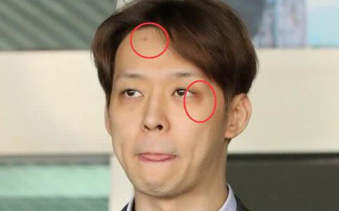 Yoochun dùng ma túy xong đập đầu vào tường, dấu vết còn y nguyên trên trán trong ngày bị còng tay?
