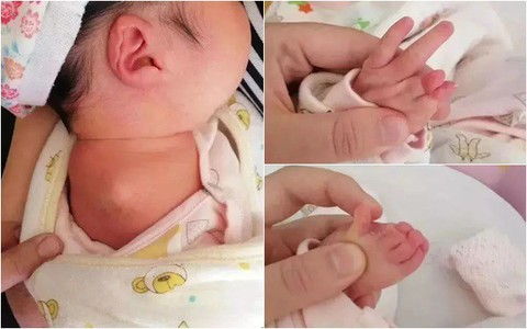 Khám trước sinh không phát hiện dấu hiệu bất thường, đến ngày lâm bồn mẹ bật khóc khi nhìn thấy con