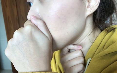 Cô gái 21 tuổi chỉ sống được 5 ngày sau khi phát hiện bị ung thư: Cảnh báo dấu hiệu ai cũng phải chú ý