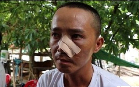 Ba cha con bị 20 người truy sát: Nạn nhân phẫn uất kể 3 trận đánh trong một buổi chiều