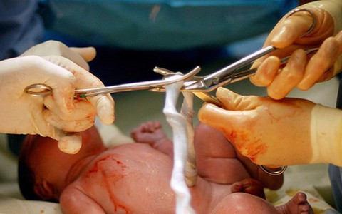 Chậm cắt dây rốn vài phút con sẽ được hưởng vô vàn lợi ích, mẹ bầu nhớ yêu cầu bác sĩ thực hiện
