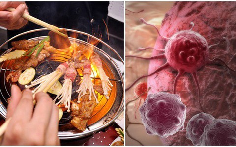 Bác sĩ ung bướu tiết lộ 6 thủ phạm gây ung thư ác tính, dù là ai cũng cần đọc kỹ để tự cứu mình