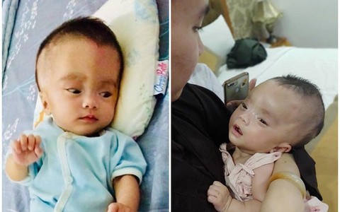Triệu Hoài An - bé gái chiến đấu với căn bệnh não nước bằng tất cả sự lạc quan đã ra đi mãi mãi