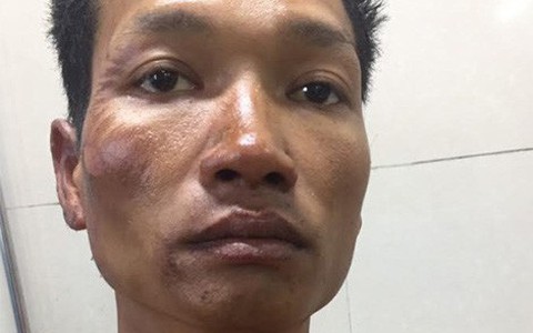 Lên cơn ghen, phóng hỏa đốt nhà rồi dìm chết vợ dưới bể nước