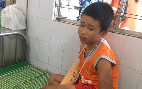 Hoàn cảnh thương tâm của cậu bé bán vé số bị đánh gãy tay, cướp 1,2 triệu đồng